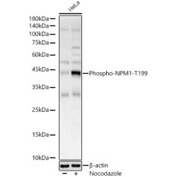 Phospho-NPM1-T199 Rabbit pAb