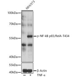 Phospho-NF-kB p65/RelA-T435 Rabbit pAb