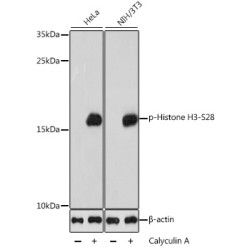 Phospho-Histone H3-S28 Rabbit pAb