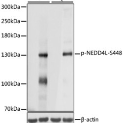 Phospho-NEDD4L-S448 Rabbit pAb