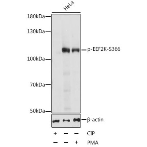 Phospho-EEF2K-S366 Rabbit pAb