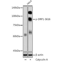 Phospho-DRP1-S616 Rabbit pAb
