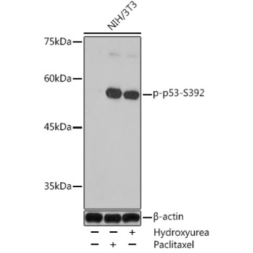 Phospho-p53-S392 Rabbit pAb