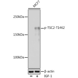 Phospho-TSC2-T1462 Rabbit pAb