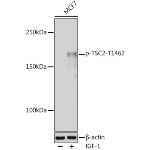 Phospho-TSC2-T1462 Rabbit pAb