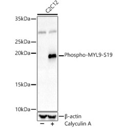 Phospho-MYL9-S19 Rabbit pAb