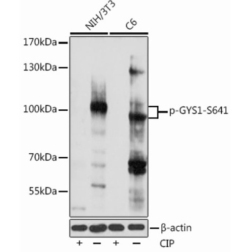 Phospho-GYS1-S641 Rabbit pAb