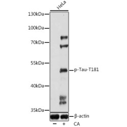 Phospho-Tau-T181 Rabbit pAb