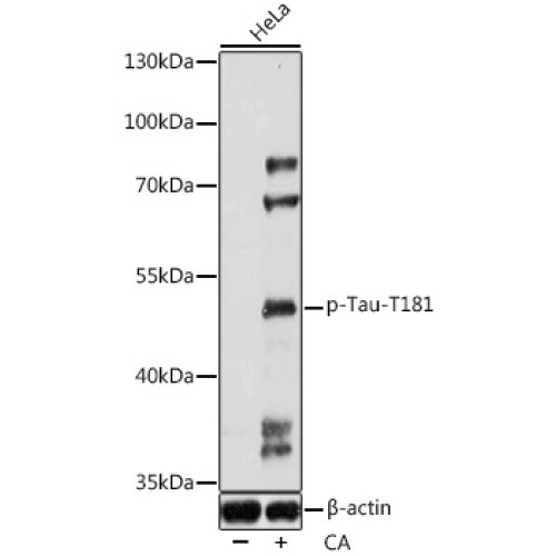 Phospho-Tau-T181 Rabbit pAb