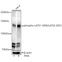 phospho-LATS1-S909/LATS2-S872 Rabbit pAb
