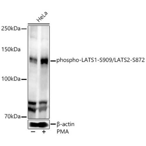 phospho-LATS1-S909/LATS2-S872 Rabbit pAb