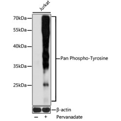 Pan Phospho-Tyrosine Rabbit pAb