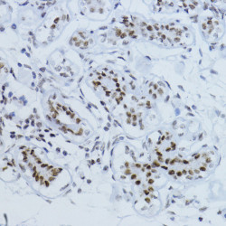 Phospho-Smad2-T220 Rabbit pAb
