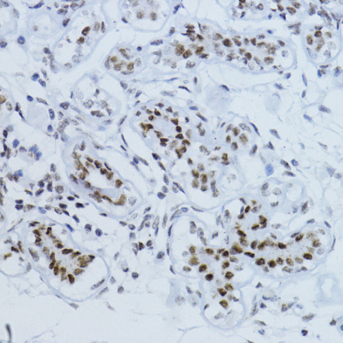 Phospho-Smad2-T220 Rabbit pAb