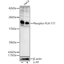 Phospho-PLN-T17 Rabbit pAb