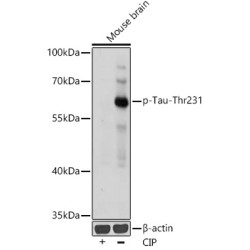 Phospho-Tau-T231 Rabbit pAb