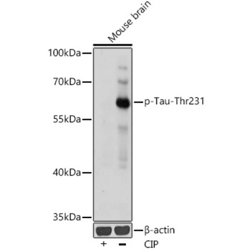 Phospho-Tau-T231 Rabbit pAb