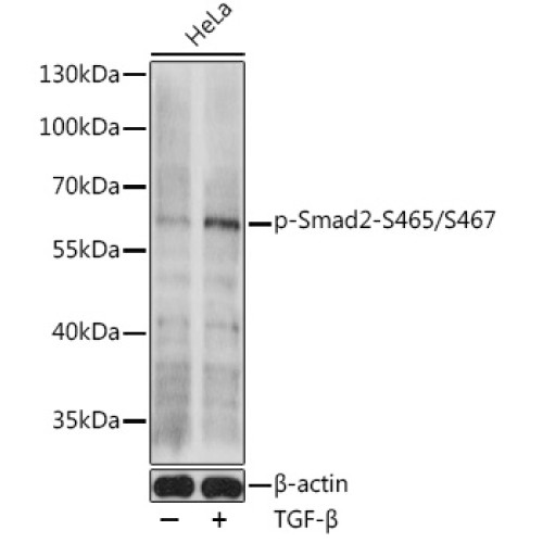 Phospho-Smad2-S465/S467 Rabbit pAb