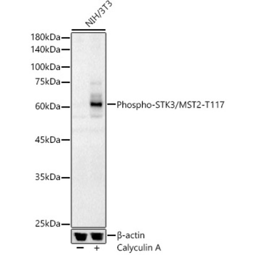 Phospho-STK3/MST2-T117 Rabbit pAb