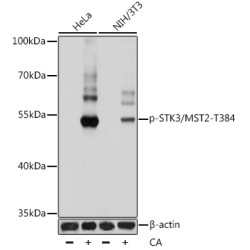 Phospho-STK3/MST2-T384 Rabbit pAb
