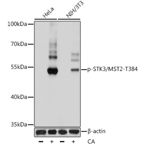 Phospho-STK3/MST2-T384 Rabbit pAb