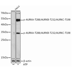 Phospho-AURKA-T288/AURKB-T232/AURKC-T198 Rabbit pAb