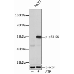 Phospho-p53-S6 Rabbit pAb