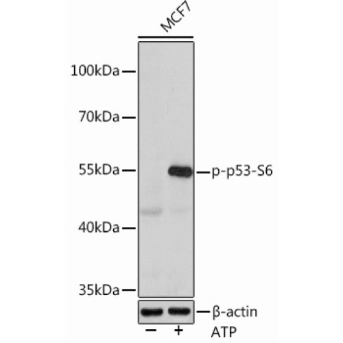 Phospho-p53-S6 Rabbit pAb