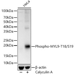 Phospho-MYL9-T18/S19 Rabbit pAb