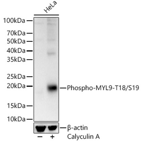 Phospho-MYL9-T18/S19 Rabbit pAb