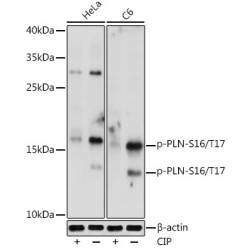 Phospho-PLN-S16/T17 Rabbit pAb