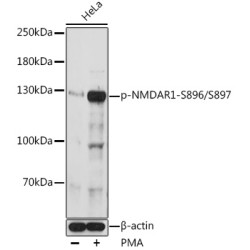 Phospho-NMDAR1-S896/S897 Rabbit pAb