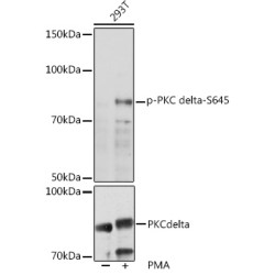 Phospho-PKC delta-S645 Rabbit pAb