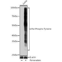 Pan Phospho-Tyrosine Mouse mAb