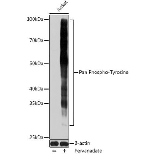 Pan Phospho-Tyrosine Mouse mAb