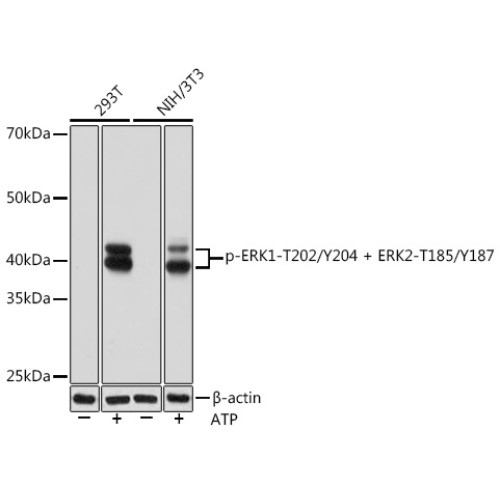 Phospho-ERK1-T202/Y204 + ERK2-T185/Y187 Rabbit mAb