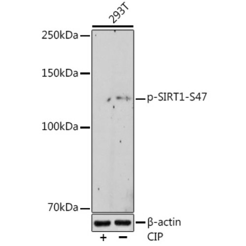 Phospho-SIRT1-S47 Rabbit mAb