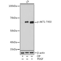 Phospho-AKT1-T450 Rabbit mAb