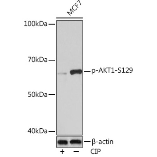 Phospho-AKT1-S129 Rabbit mAb