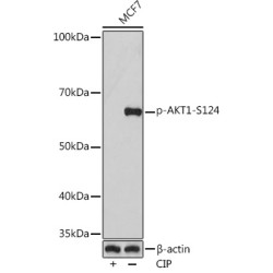 Phospho-AKT1-S124 Rabbit mAb