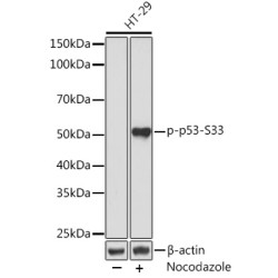 Phospho-p53-S33 Rabbit mAb