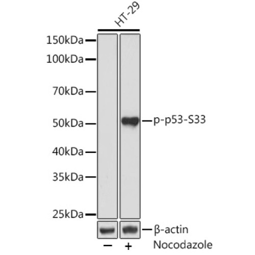 Phospho-p53-S33 Rabbit mAb