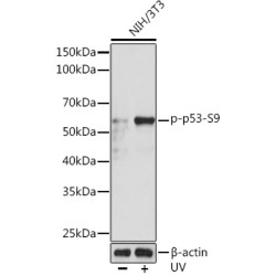 Phospho-p53-S9 Rabbit mAb