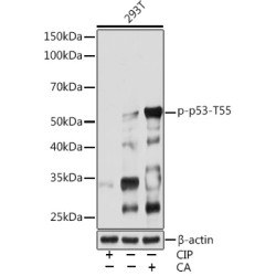 Phospho-p53-T55 Rabbit mAb