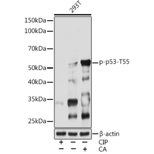 Phospho-p53-T55 Rabbit mAb