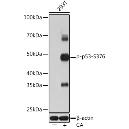 Phospho-p53-S376 Rabbit mAb