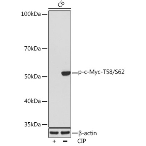 Phospho-c-Myc-T58/S62 Rabbit mAb