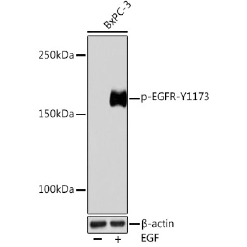 Phospho-EGFR-Y1173 Rabbit mAb
