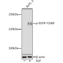 Phospho-EGFR-Y1068 Rabbit mAb