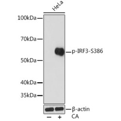 Phospho-IRF3-S386 Rabbit mAb